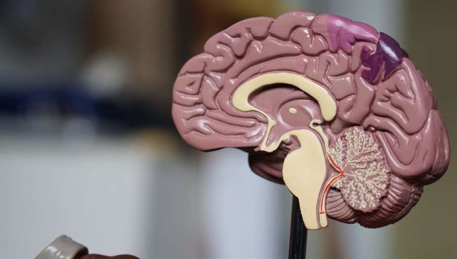Российские ученые создали ПО для выявления и анализа изменений в строении мозга